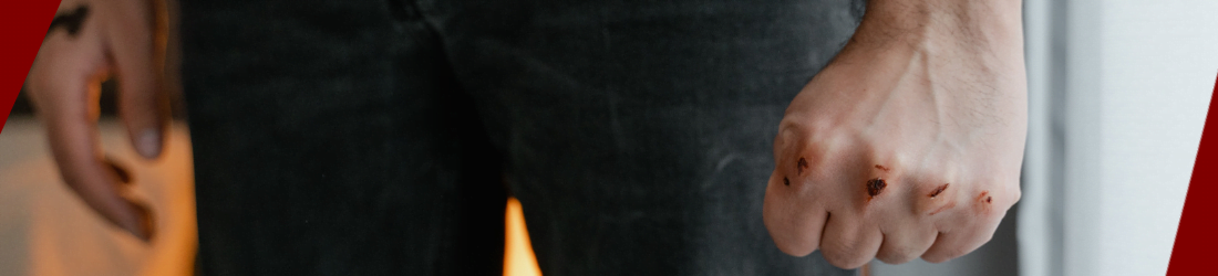 Régimen de excepción en El Salvador no frena agresión machista