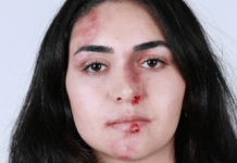 Indicios de abuso en las relaciones y cómo ayudar