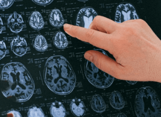 Interacciones Mente-Cuerpo en la salud