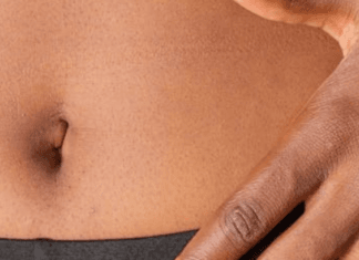 ¿Es cierto que toda enfermedad comienza en el intestino?