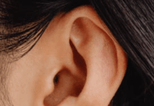 Casi el 20 % de la población mundial viven con pérdida auditiva