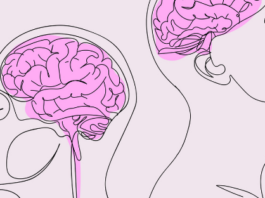 Tinnitus: cuando el cerebro canta en silencio