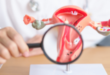 El cáncer cervicouterino exige más que vacunas