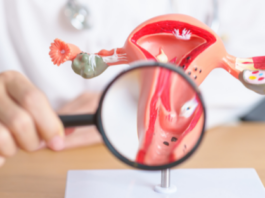 El cáncer cervicouterino exige más que vacunas