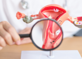 El cáncer cervicouterino exige más que vacunas