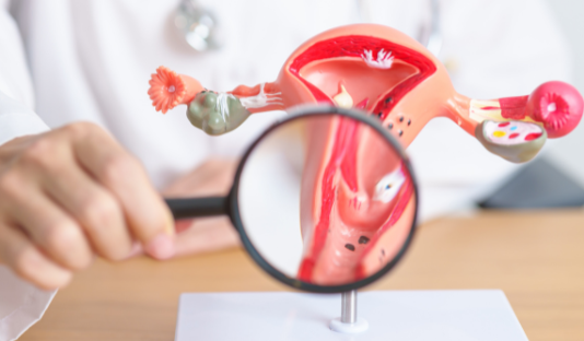 El cáncer cervicouterino exige más que vacunas